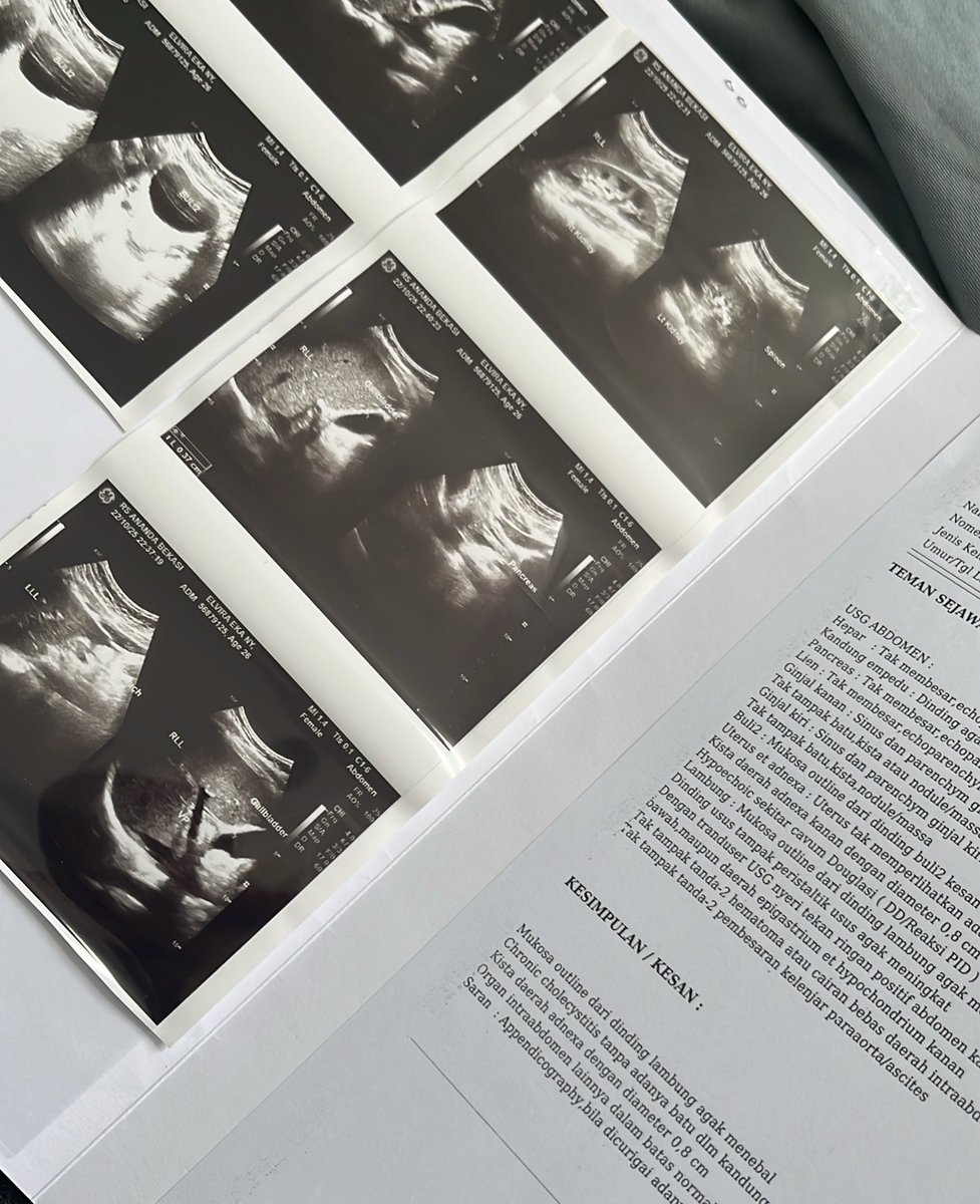 🫧🎀🔪 tweet media