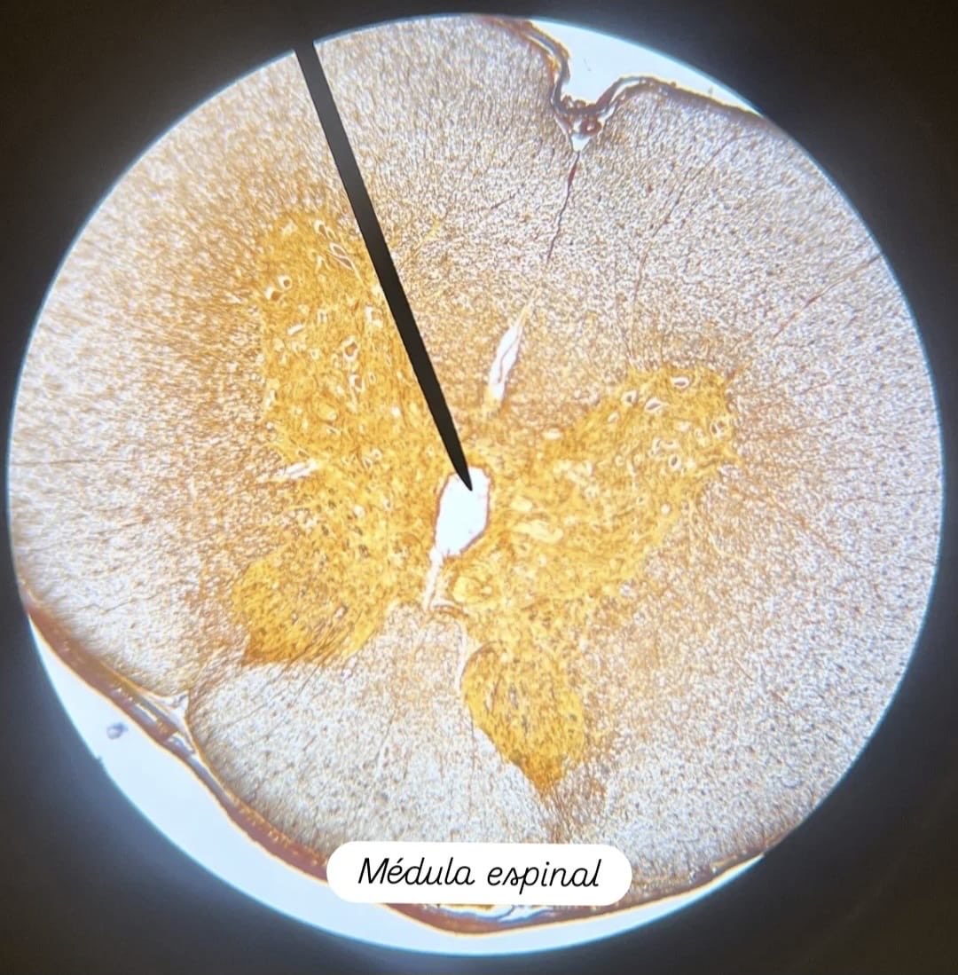 El alumnado de 1.º de Bachillerato de Biología ha realizado una práctica de microscopía 🔬, en la que han identificado distintas muestras de tejidos animales 🧫 y familiarizarse con las técnicas de observación al microscopio
¡Las fotos son suyas! 📸 Tomadas a través del ocular.
