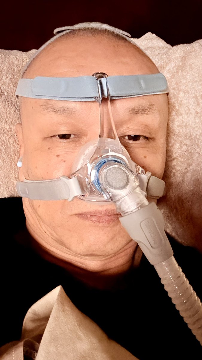 mimuBAR's tweet image. 昨日からcpap治療開始
初日から効果を体感！
睡眠で疲れが癒える事の体感
『こんなもん鼻に着けて寝れるか‼️』と感じ、慣れずに何度も目覚めたけど、疲れは取れた
キャンプにも旅行にも連れて行く相棒
#睡眠時無呼吸症候群　#cpap