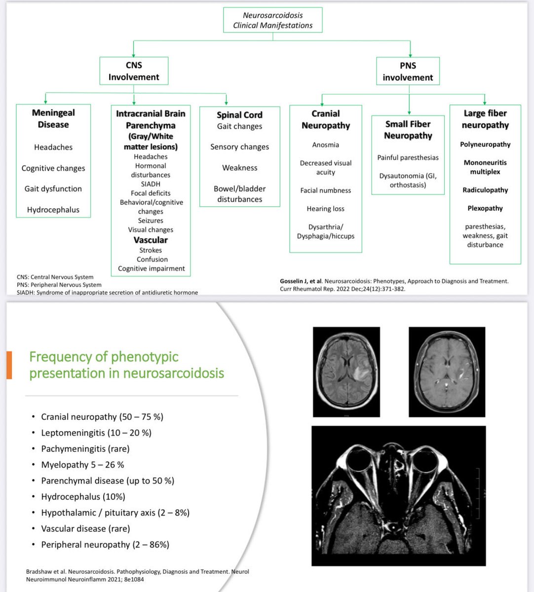 🧠 Neurosarcoidosis — a true neuroimmunology puzzle.
From cranial neuropathies to spinal cord &amp; small fiber involvement — it can mimic almost anything.

📊 Cranial neuropathy: 50–75%
Parenchymal disease: up to 50%
Peripheral neuropathy: up to 86%

#ACR25 #Rheumatology