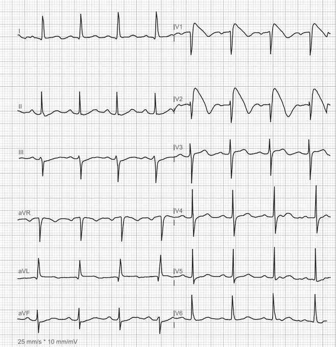 Antonio Arroyo, MD. Medico Cirujano. tweet media