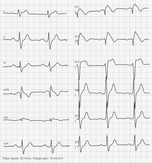 Antonio Arroyo, MD. Medico Cirujano. tweet media