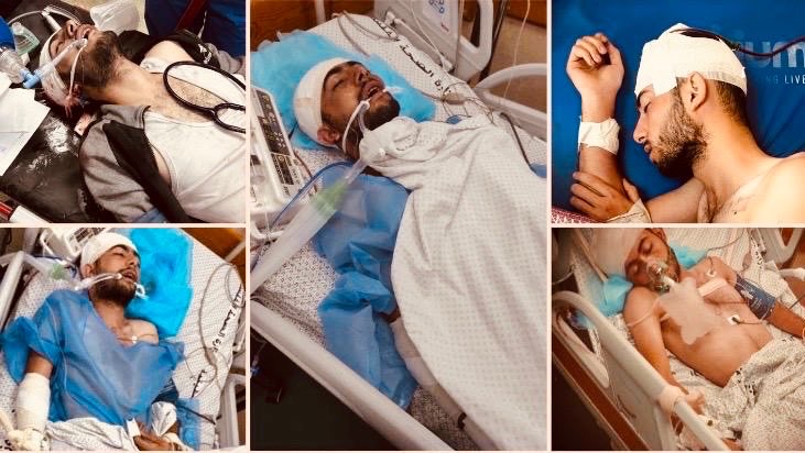 a_h_alabadla's tweet photo. I survived when my house collapsed over my family.
I carry their memory every day — and fight to stay alive.
Your support can change my life and honor theirs 🕊️
🙏 https://t.co/qmzWXakdYE
#GazaUnderAttack #StandWithGaza #HelpTheInjured #RebuildLives #SaveHumanity #SupportGaza https://t.co/HriclohmLf