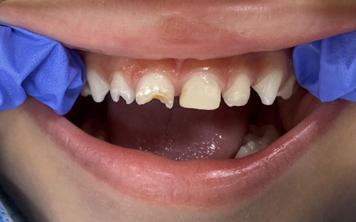 رِهاف tweet media