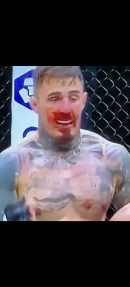 Takeflight214's tweet photo. @WestTillDeath If you thin Gaine did him dirty on the feet, I can’t wait to see what a boxer is gonna do 😂🤣 https://t.co/5hmggmLlPK