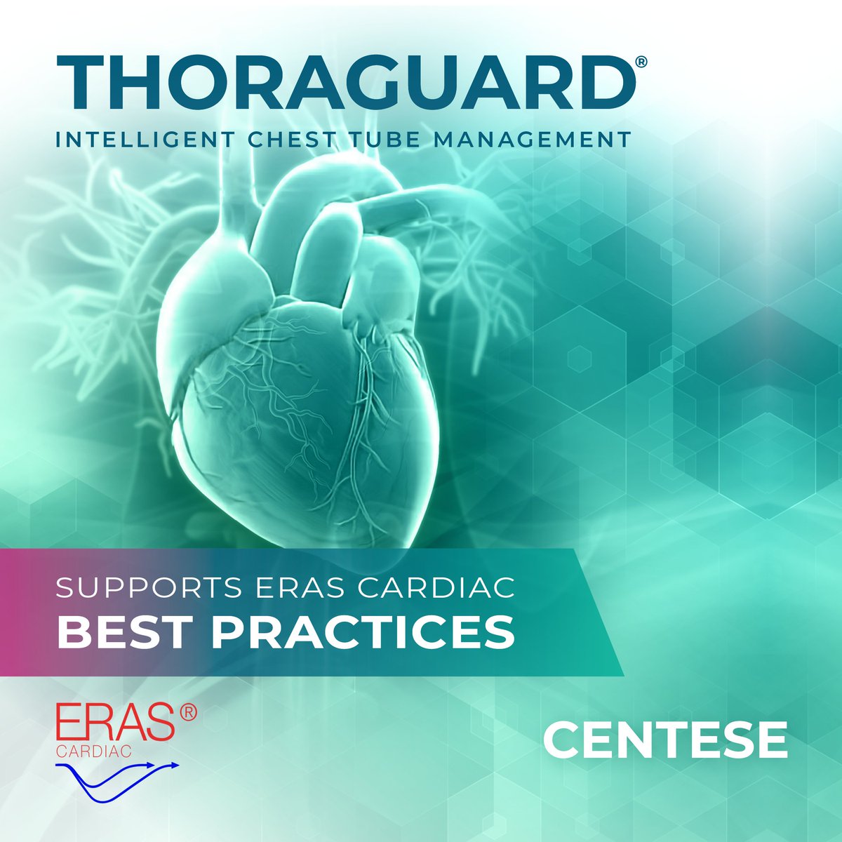 ERAS Cardiac guidelines recommend maintaining chest tube patency following cardiac surgery.*

Digital drainage systems like Thoraguard can help support compliance. Learn more: jtcvsopen.org/article/S2666-…

*Daniel T. Engelman, MD, et al. JAMA Surgery. 2019.
@earascardiac