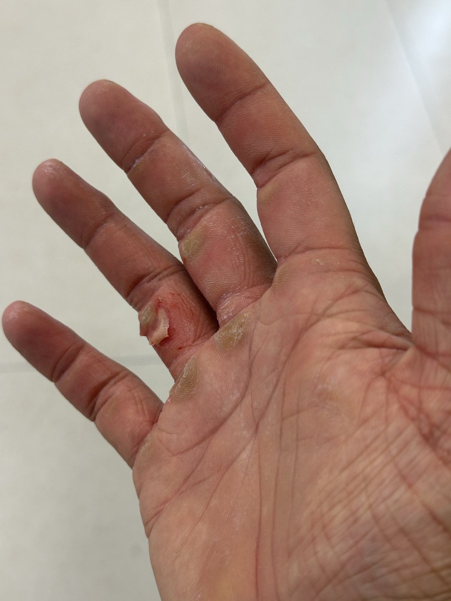 Bleaker（秋招版 tweet media