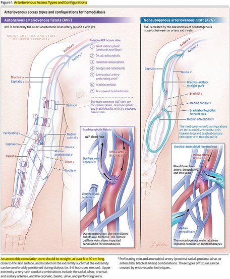 Nefro_Tweets tweet media