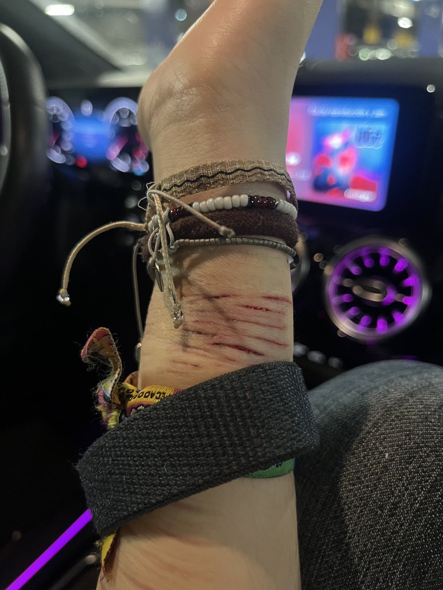 si estuviésemos en invierno me hubiese hecho tremendos beans en las piernas