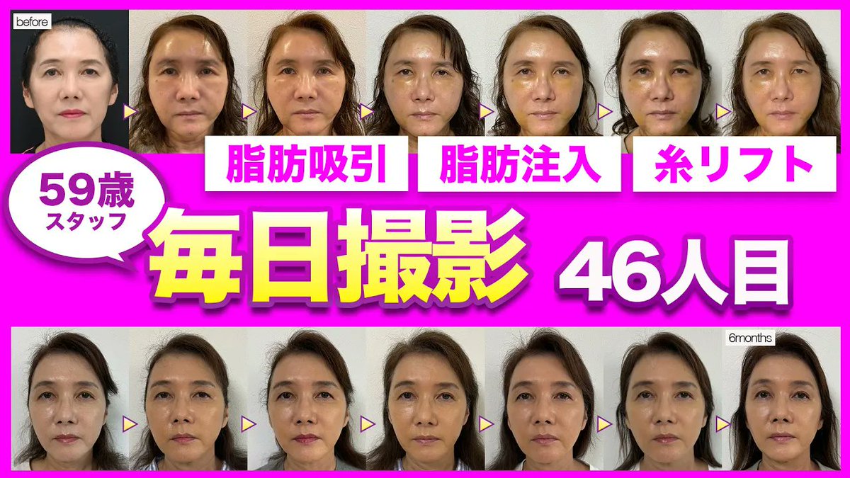 美容外科専門医】秋葉原院院長 名倉俊輔 on X