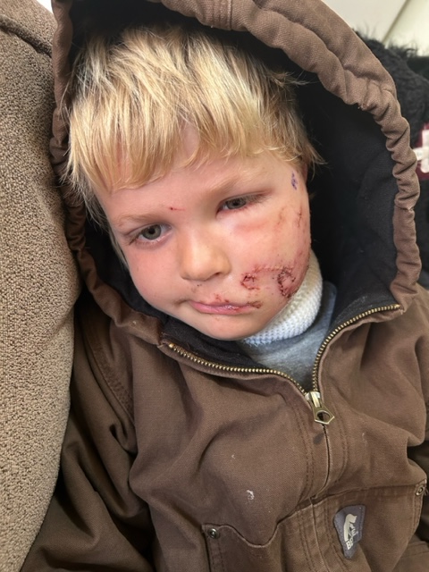 A 5-year-old boy from southern Utah is recovering after being bitten in the face by a dog over the weekend.

Leo’s father, Brayden Fuller, said his son was playing with friends Saturday morning when he went to hug a friend’s dog. The dog bit Leo’s face and shook him, leaving