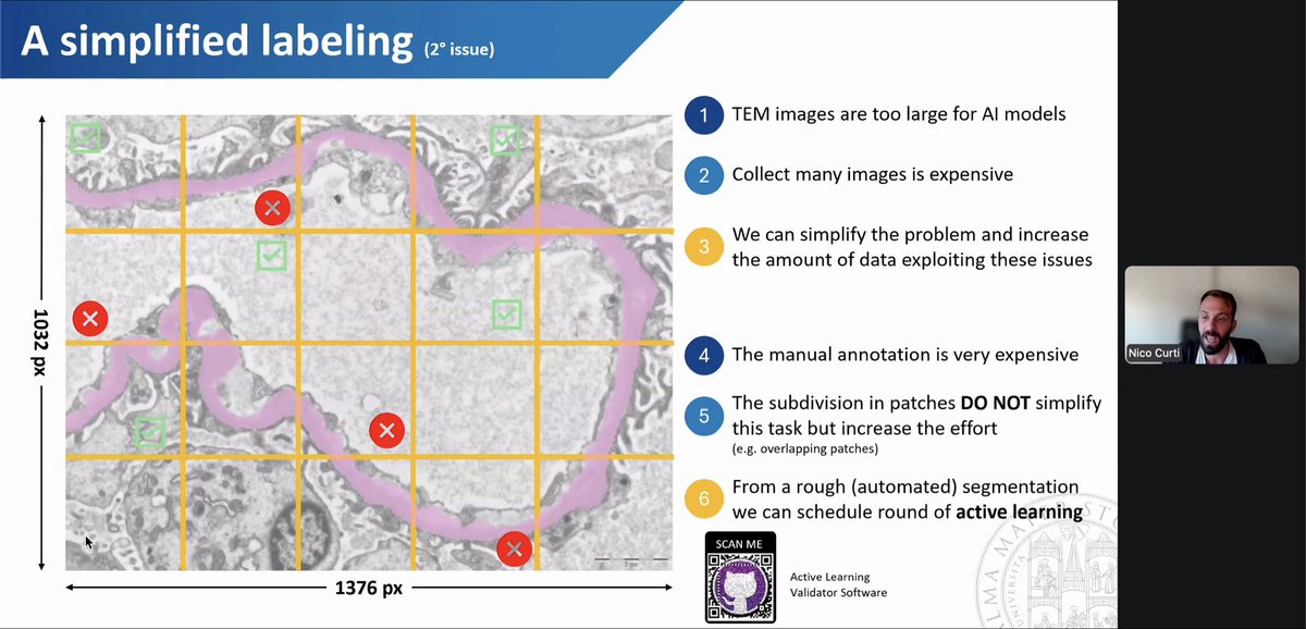 Wonderful session: AI for EM <a href="/ESP_Pathology/">European Society of Pathology (ESP)</a>

Requirements and strategies for feeding AI model 🤖

<a href="/kidneypathology/">Carmen Avila</a>