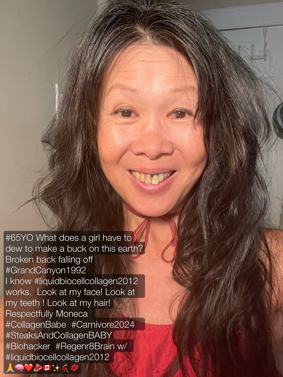 HumanDesignBabe's tweet image. #65YOBoomer #ConcussionRecovery   #15Concussions 
#collagen 4 #Concussions 
My #ShakleeShop  
link is in my bio.  
#liquidbiocellcollagenPURE 
Stevia because #LIFECollagen  
is too sweet for me. 
Respectfully Moneca 
#CollagenBabe  #SteaksAndCollagenBABY  #Biohacker