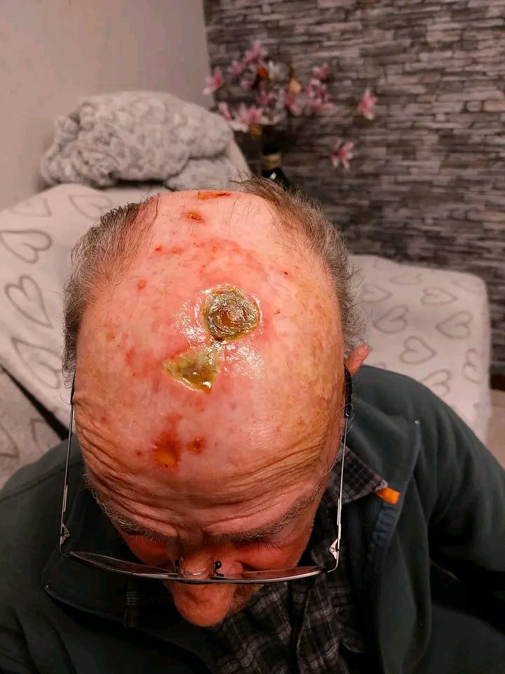 Haltecancer's tweet image. Jean MILLAU attend votre aide pour son opération...6300 Euros 

@toutlemonde
#infocancers
#cancermonde
#EuropeanUnion 
@infospourtous