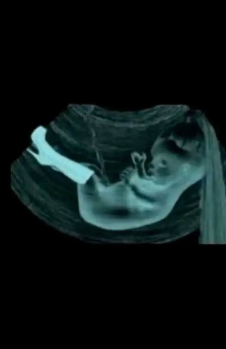 น้องเตนล์