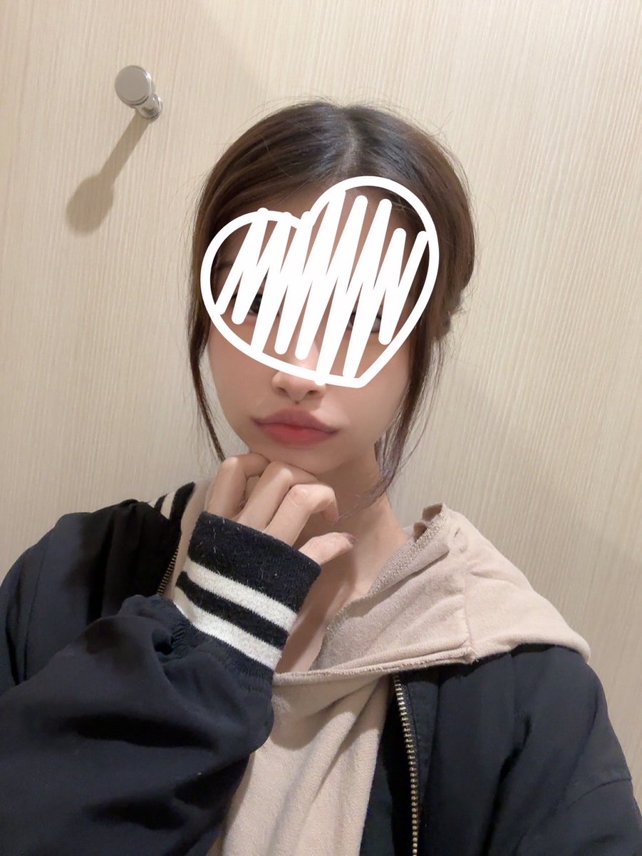 Osutoki's tweet photo. 口元術後9日‼️
まだ腫れぼったいけど手術直後からほんとに傷口綺麗すぎて今ではもうほぼ傷口ない https://t.co/byKuB7fem3