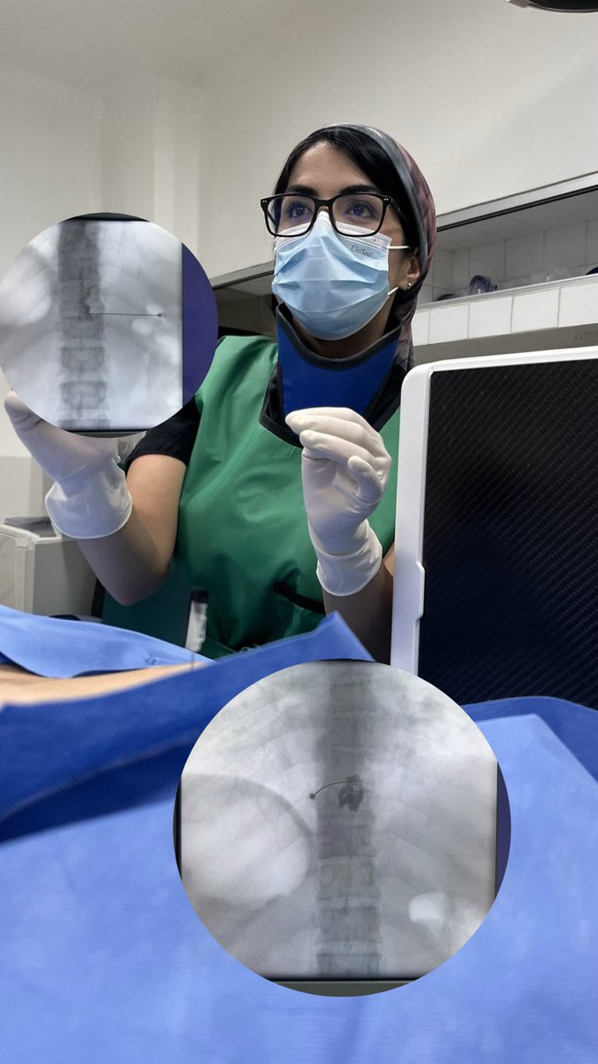 StphFlo's tweet image. Inhibición química de Nervios Esplácnicos para manejo intervencionista de dolor Oncológico 🦋
@HospitalCivil