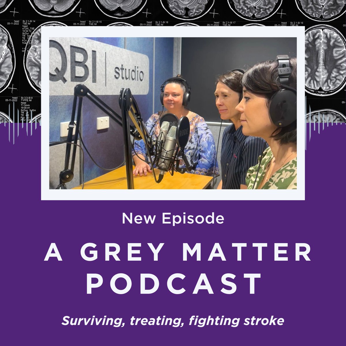 QldBrainInst's tweet photo. “I thought it was a migraine… not for one second did I even think young people could have strokes.”

On this special World Stroke Day podcast, three inspiring women share their unique perspectives on surviving, treating, and researching stroke. 

From parenting through recovery to rehab strategies to cutting-edge brain science, their stories reveal the stroke recovery journey. 

🎧 Listen now: https://t.co/a1XNrXTovb

This is the third episode of A Grey Matter’s new season. Tune in every fortnight for fresh conversations at the intersection of neuroscience, innovation, and hope.

#UQ #QBI #BrainResearch #neuroscience #AGreyMatter #stroke #strokerecovery #braininjury #WorldStrokeDay @matildebalbi