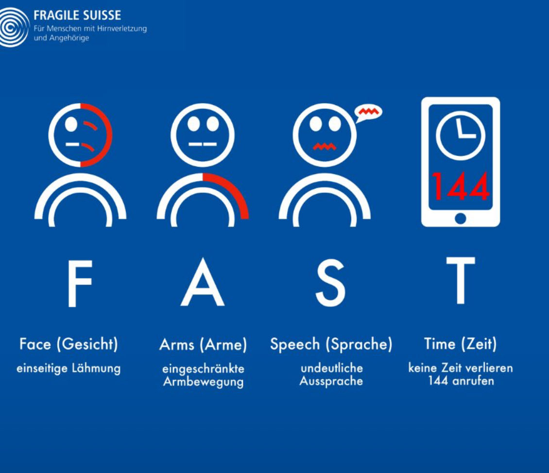 Heute ist der Welttag des Schlaganfalls 

eine gute Gelegenheit, hier die Anzeichen eines Schlaganfalls. Symptome treten meist plötzlich und an einer Körperhälfte auf. Dazu gehören unter anderem heftige Kopfschmerzen, Sehstörungen, Gleichgewichtsprobleme, Schwindel und Übelkeit.