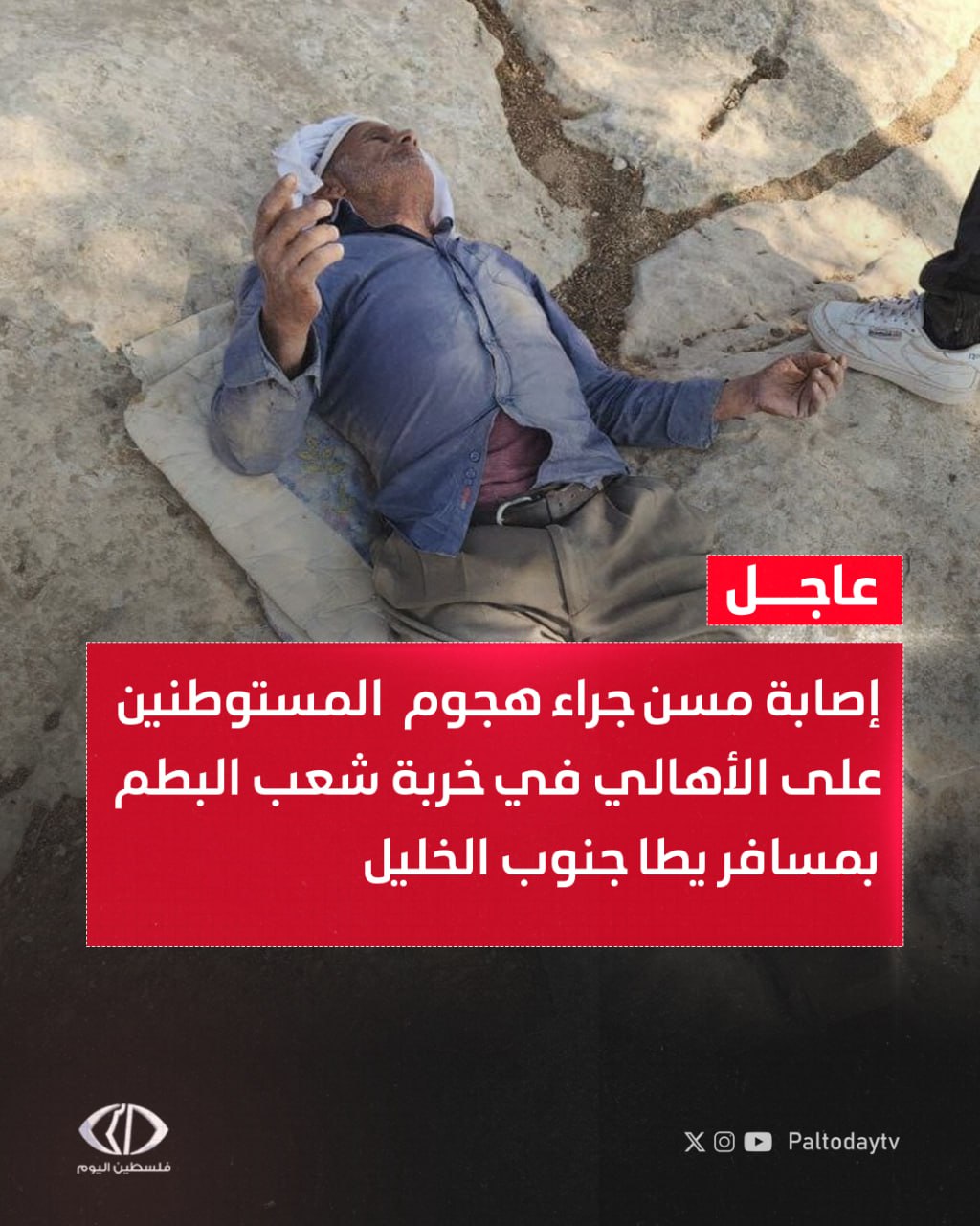 عاجل | إصابة مسن جراء هجوم المستوطنين على الأهالي في خربة شعب البطم بمسافر يطا جنوب #الخليل 