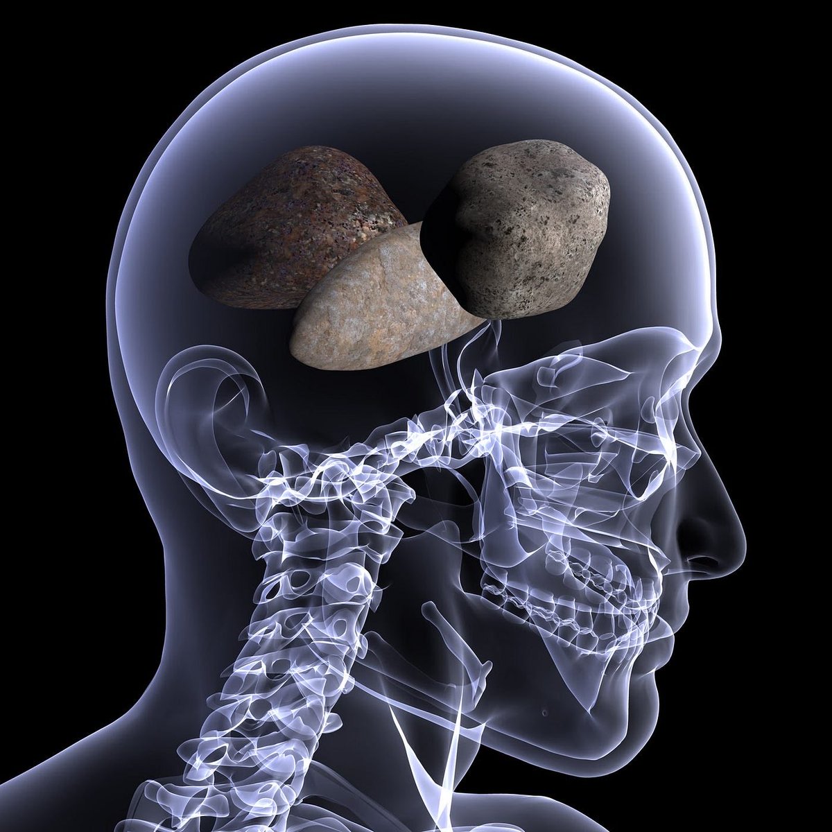 Every Arsenal fan on this bloody app