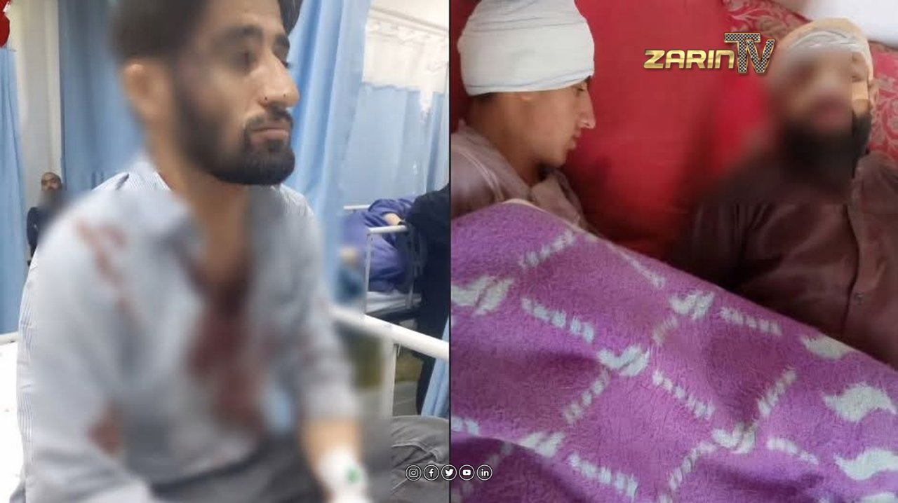 پسر فرمانده طالبان در تخار شش نفر را زخمی کرد