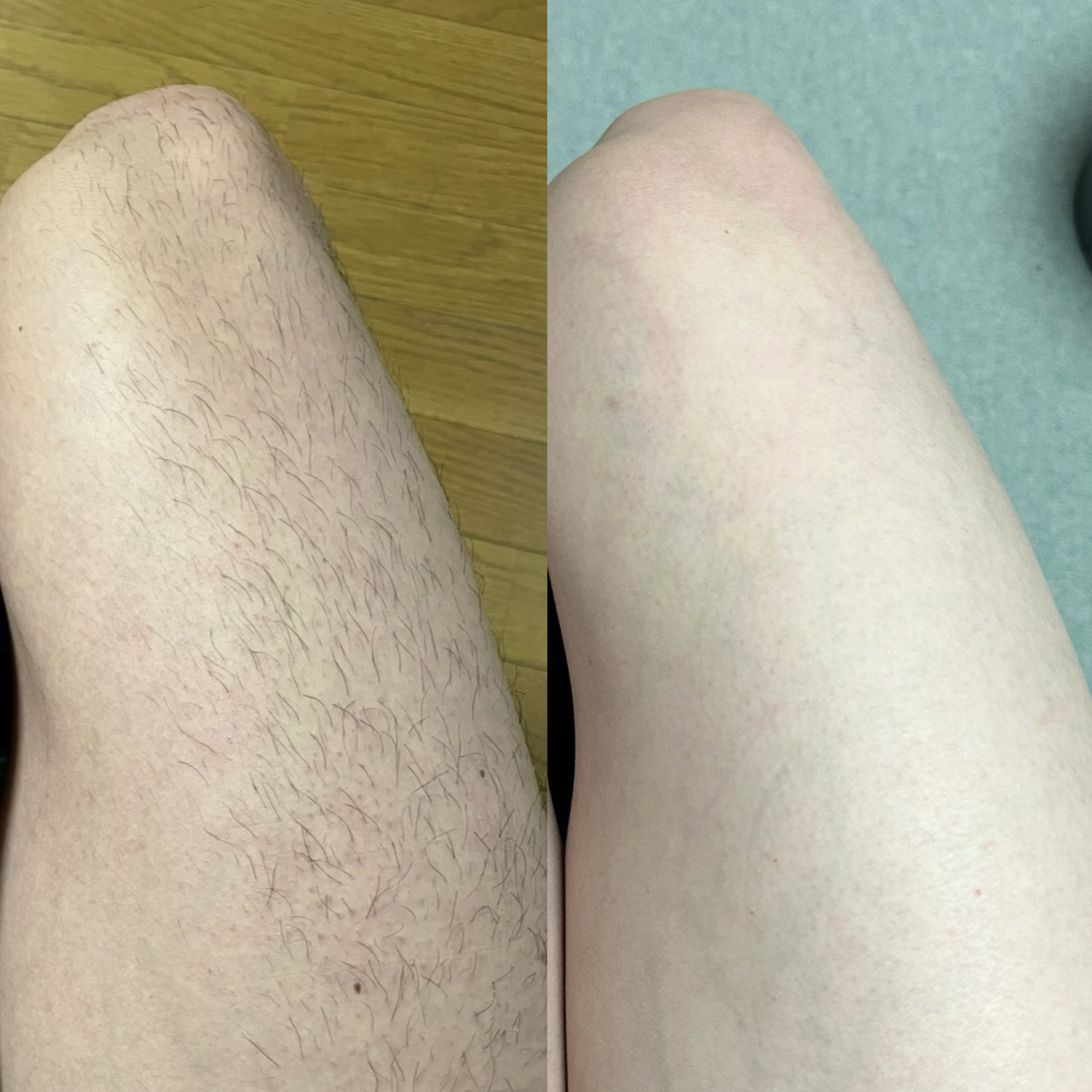 ケノン - Search / X