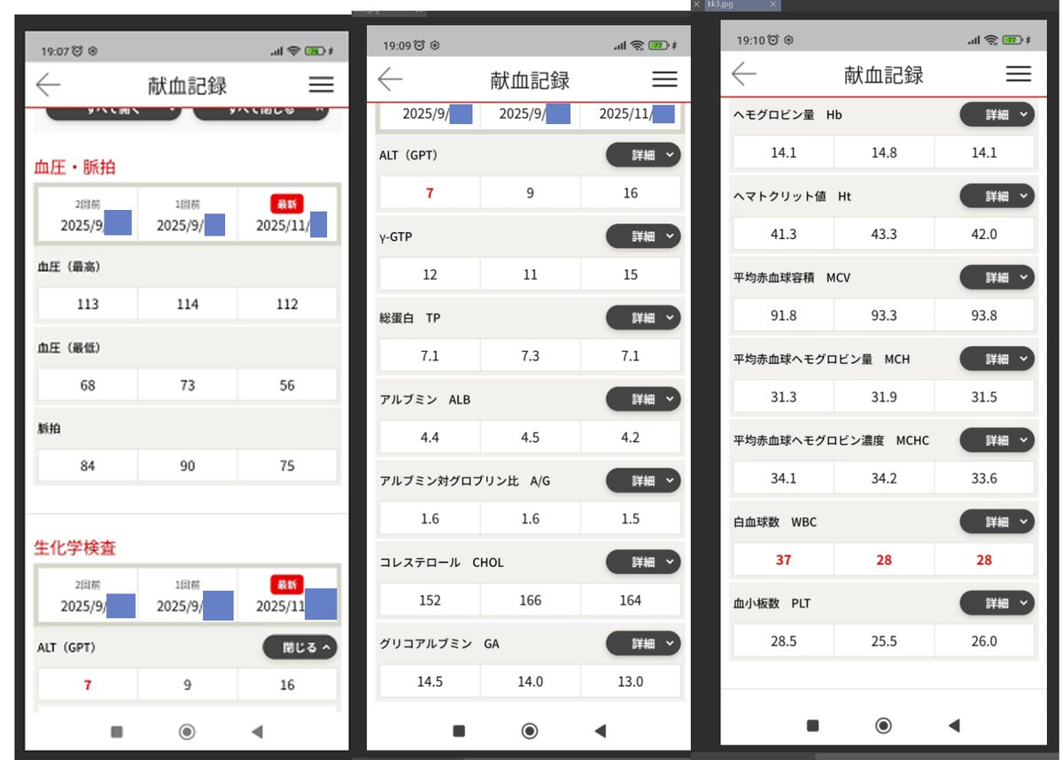 #筋トレ　#献血　#血液検査　
筋トレ、一カ月後の結果を、ショート動画にでもしようと思ってたけど、あまり変化ないので止めました。せっかくなので比較画像だけ投稿。
献血所での血液検査、一番右が一か月後です。
ちな、テーマとは外れるけど、白血球数が少ないのは体質らしい。医者にすら驚かれるｗ