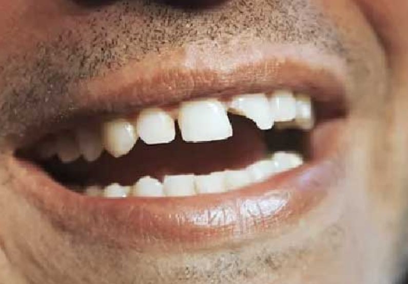 Les fourchettes comestibles Sodebo: