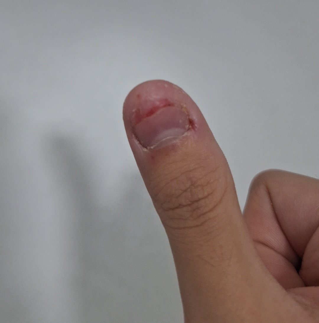 guys I'm back o levels was horrible but do you think i shld get my nails done for prom? i have a rlly bad habit of picking my nails and idk if the nail artists are gonna judge...(´・c_・`)

it's really horrible I'm not exaggerating...tw :')