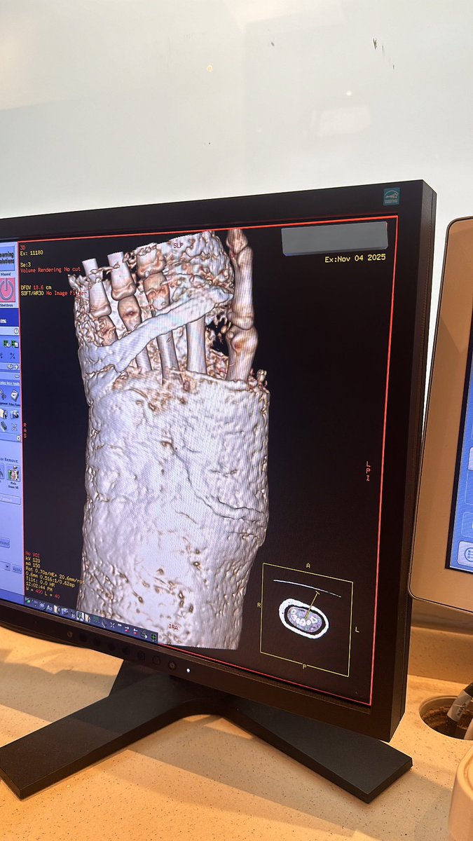 wasan|🩻. tweet media