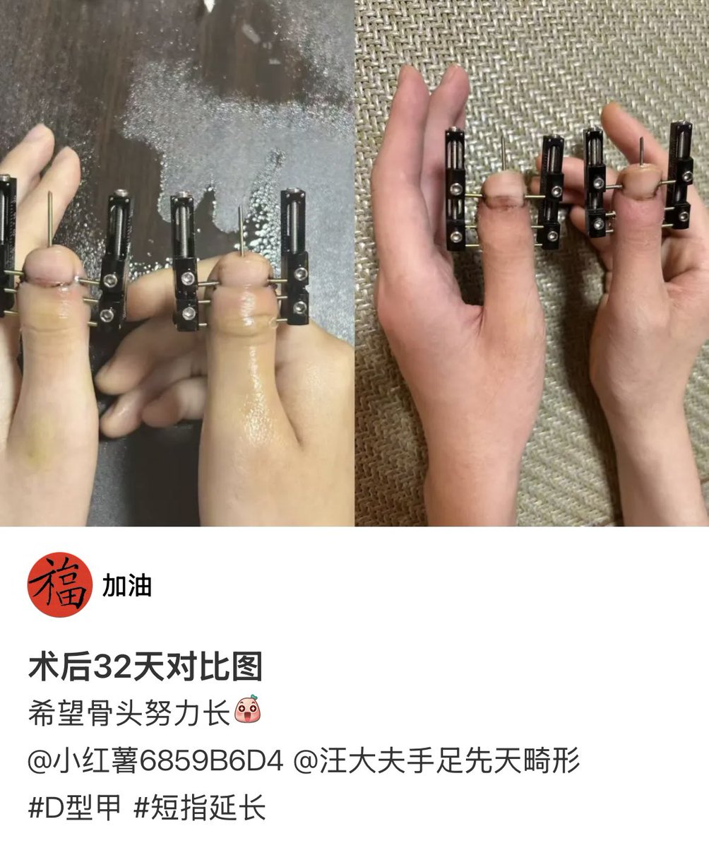 放手一搏 tweet media