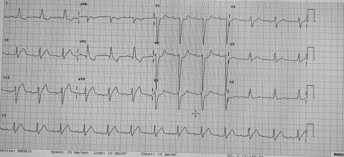 Asanka Migelheva tweet media