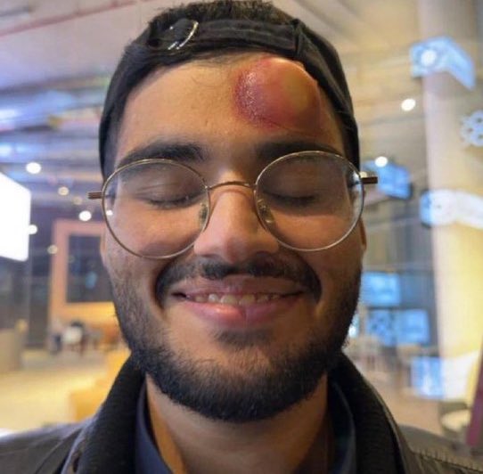 L’état du caméraman qui s’est pris le coup franc de Ronaldo 😭😭😭😭