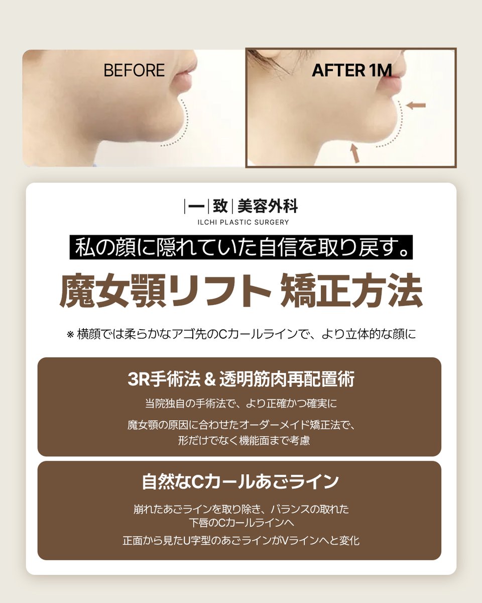 裁断済み） 顔の外科 裁断済み】顔の外科 facial surgery 小川令 裁断