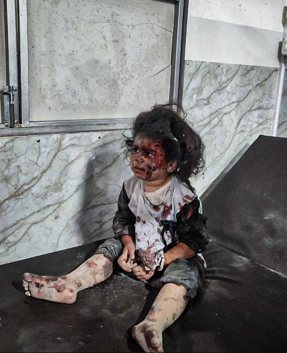 ShehabAgency's tweet photo. #صورة | طفلة أصيبت جرّاء قصف إسرائيلي استهدف منازل سكنية وخيام تؤوي نازحين مناطق متفرقة من قطاع غزة، فجر اليوم. https://t.co/phe0x1wvcJ