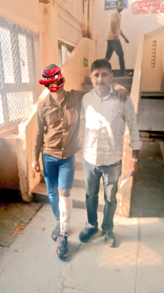 क्रिमिनल का शुद्धिकरण जारी है कल साउथ ईस्ट की तो आज नार्थ ईस्ट की बारी है I कल तेजस लुड़का आज इमरान के लड़खड़ाने की बारी है I NE स्पेशल स्टॉफ के साथ मुड़भेड़ में इमरान को लगी गोली I सशक्त नेतृत्व सही समाधान जय हो सीपी साहब की लगातार सख्त एक्शन के लिए 👍 <a href="/ANI/">ANI</a> <a href="/DCPNEastDelhi/">DCP North East Delhi</a>