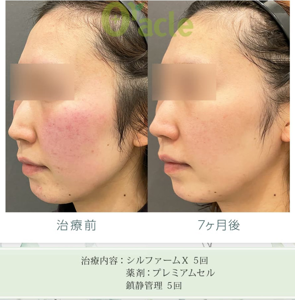オラクル美容皮膚科【公式】 (@oracleclinic) / Posts / X