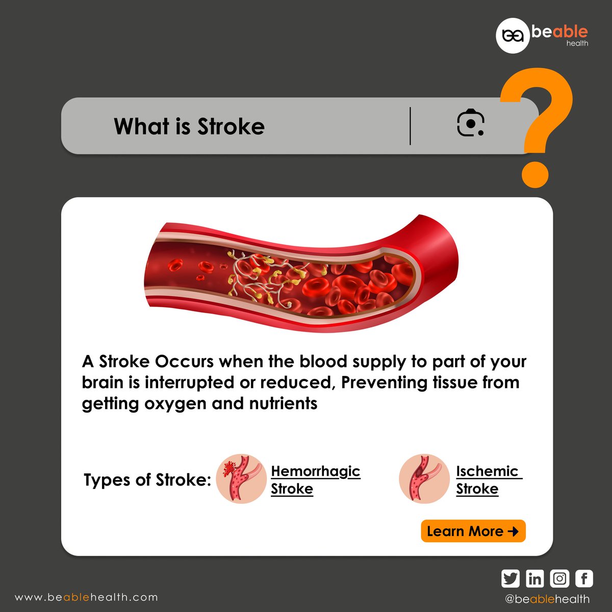 A stroke happens when blood flow to the brain is blocked cutting off oxygen and nutrients.
Two main types:
🩸 Ischemic Stroke 
💥 Hemorrhagic Stroke 

Stay aware. Act fast. Save lives.
#WorldStrokeDay2025 #StrokeAwareness #BeAbleHealth #HealthTech