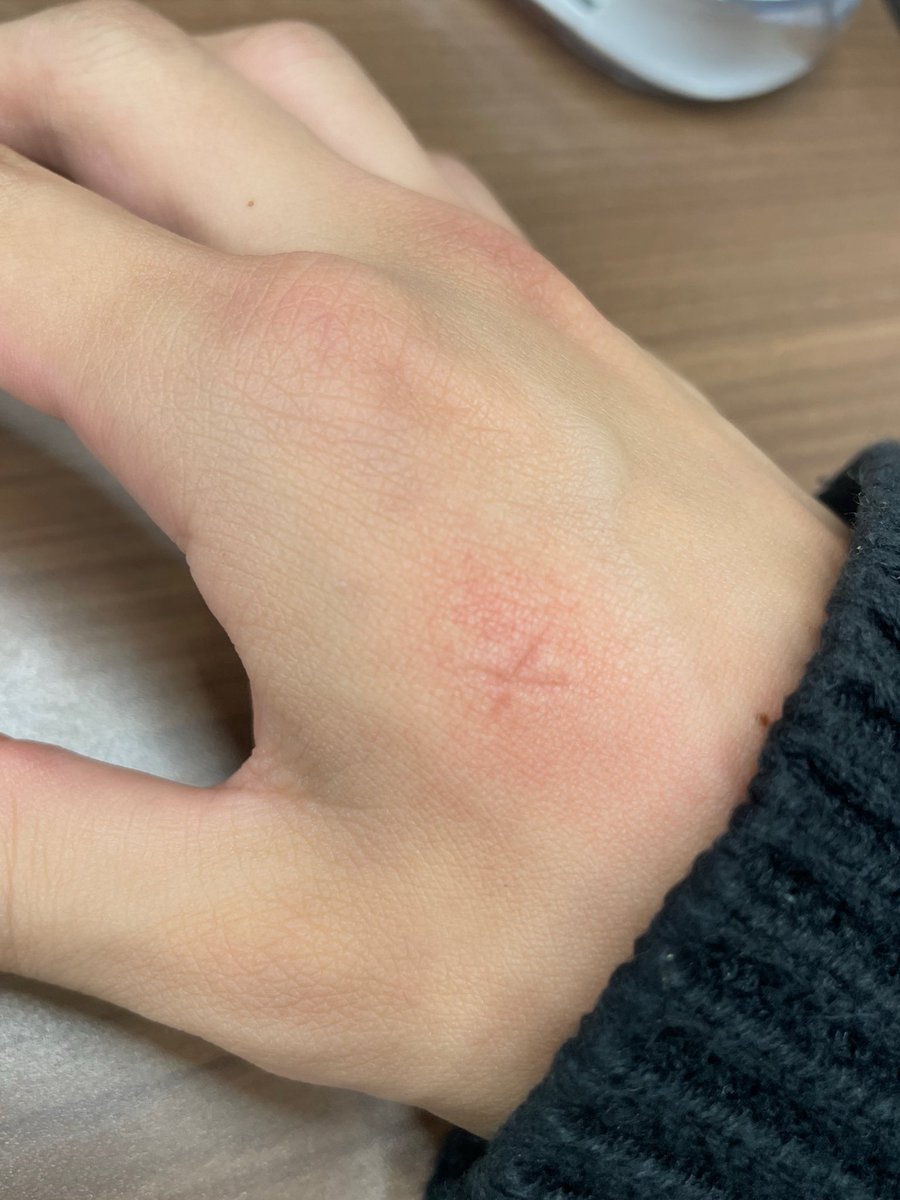 ポ*ケ様 美品⭐︎Pretty Tesora2 Dot Mastery チィ♪( * ॑꒳ ॑* ）🌸 (@sakurasakura422) / Posts / X