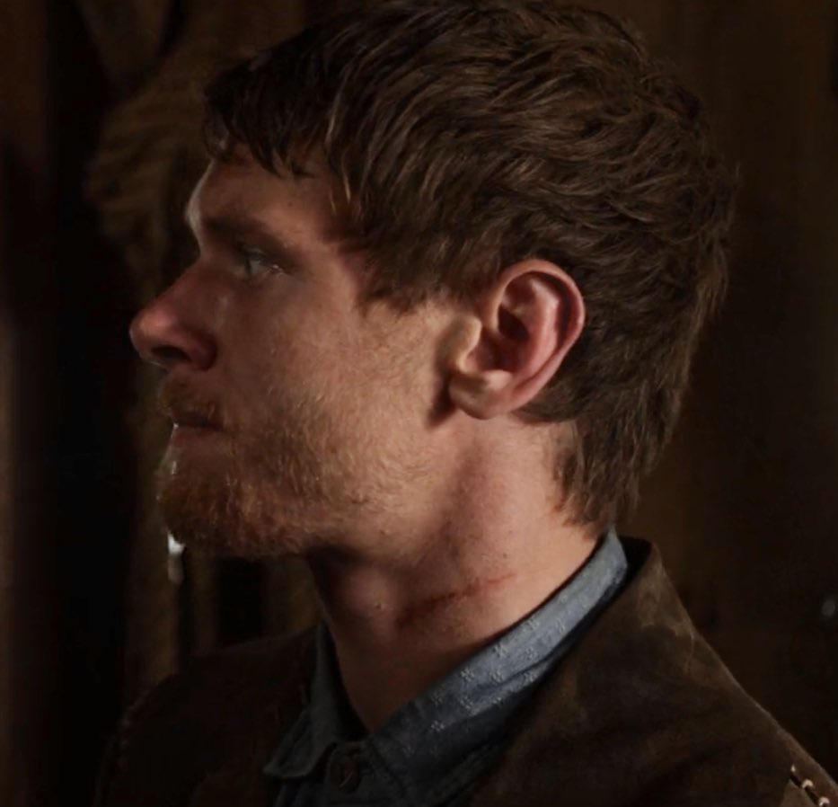 missing roy (&amp; his nose)