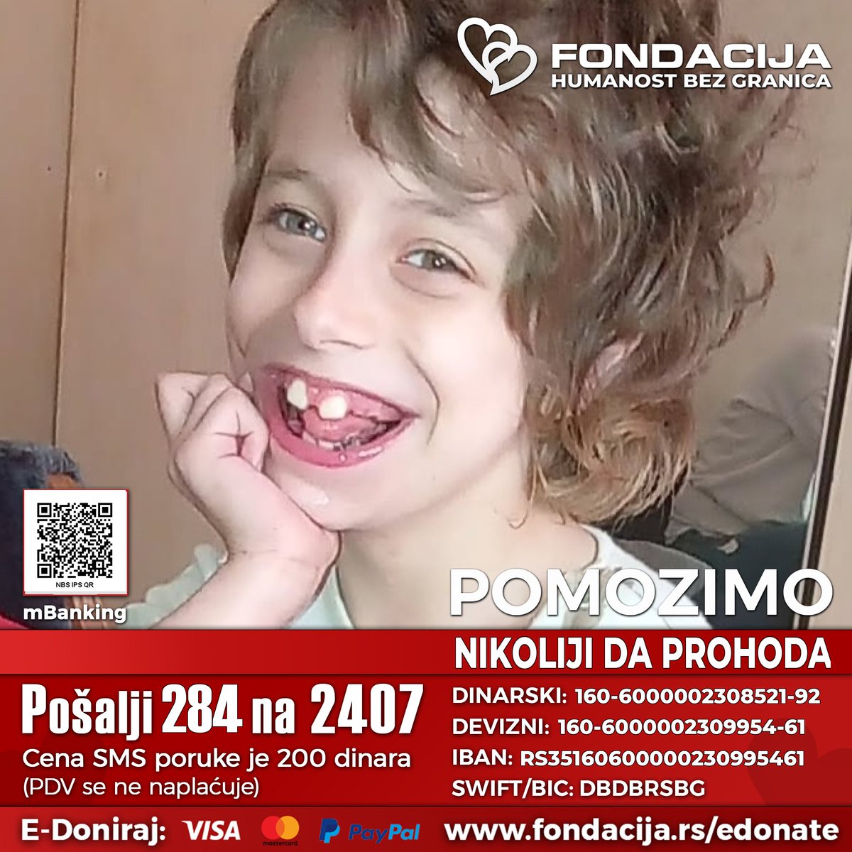 Nikolija ima cerebralnu paralizu, zastoj u razvoju, mikrocefalija, cističnu bolest bubrega i anemiju.
Pomozimo!

Pošalji SMS: 
284 na 2407

Skeniraj i doniraj:
NBS IPS QR kod

E-Doniraj - VISA, MasterCard, PayPal: fondacija.rs/korisnik/499/p…