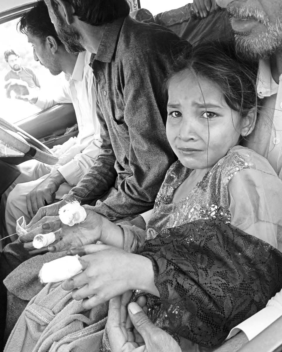 RevoltSpire's tweet photo. وادی تیراہ میں زخمی ہونے والے بچے https://t.co/GLrXDE90zw