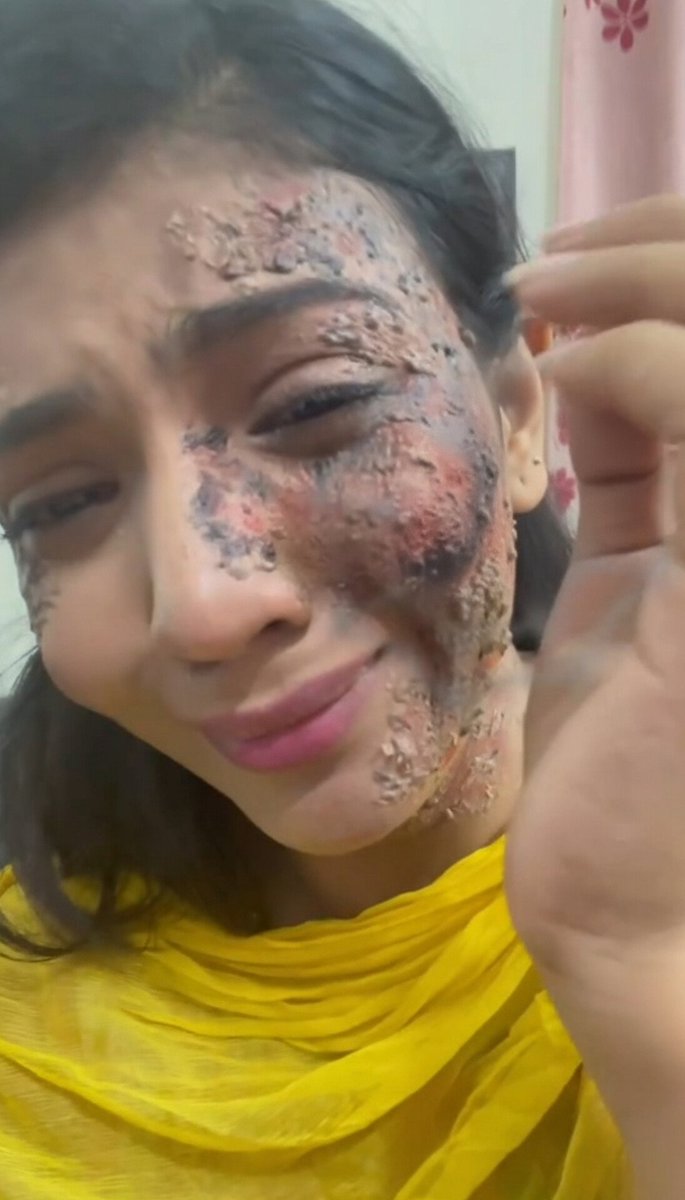 Bharatrastrasena (@bharatrastrsena) on Twitter photo Another Honda Sherni ruined in Abdul's love, read it completely and understand it. 🤡😣
This Honda Sherni married Abdul Adil Khan in 2023, changed her name from Nandini Mandal to Zara Islam, and converted to Islam. Many Hindus tried to reason with her, but she wouldn't listen. Another Honda Sherni ruined in Abdul's love, read it completely and understand it. 🤡😣
This Honda Sherni married Abdul Adil Khan in 2023, changed her name from Nandini Mandal to Zara Islam, and converted to Islam. Many Hindus tried to reason with her, but she wouldn't listen.