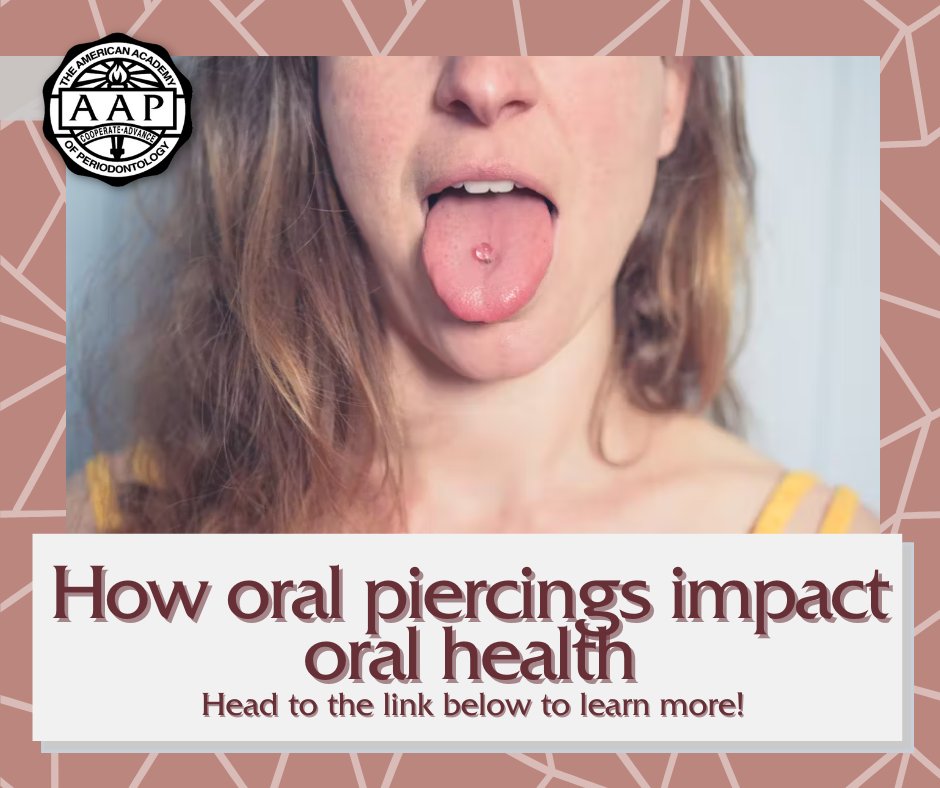 "Many people choose to get an oral piercing as a form of self-expression, but are they aware of the potential risks to their oral health? Here's what to know before getting that piercing."

Read more at the link below!

dentistryiq.com/personal-welln…