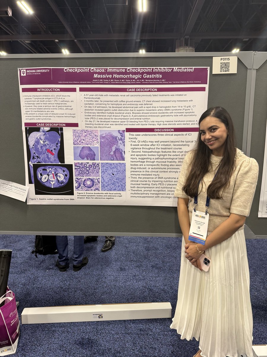 🌟 Future GI Leader Advancing Science 🌟
Proud to celebrate <a href="/SamreenJaw92664/">Samreen Jawaid</a> for an exceptional performance presenting our research at #ACG2025

Her presentations showcased innovation, clinical relevance, and a commitment to advancing gastroenterology #FutureLeaders #WomenInGI 👏🏽