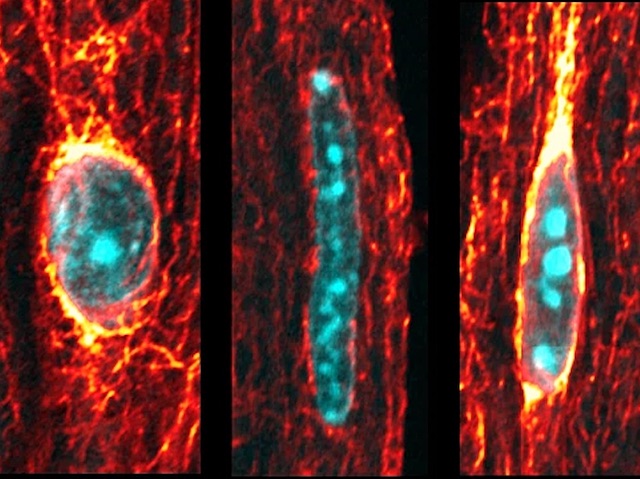 Quantifying cardiomyocyte contraction &amp; nuclear deformation interaction reveals nucleus-damaging mechanism underlying LMNA cardiomyopathy

📷 <a href="/AmiadDaria/">Daria Amiad Pavlov</a> &amp; <a href="/julieheffler/">Julie Heffler</a> et al <a href="/WeillCornell/">Weill Cornell Medicine</a> <a href="/PennMedicine/">Penn Medicine</a> in <a href="/NatureCVR/">Nature Cardiovascular Research</a> 
➡️ bpod.org.uk/archive/2025/1…