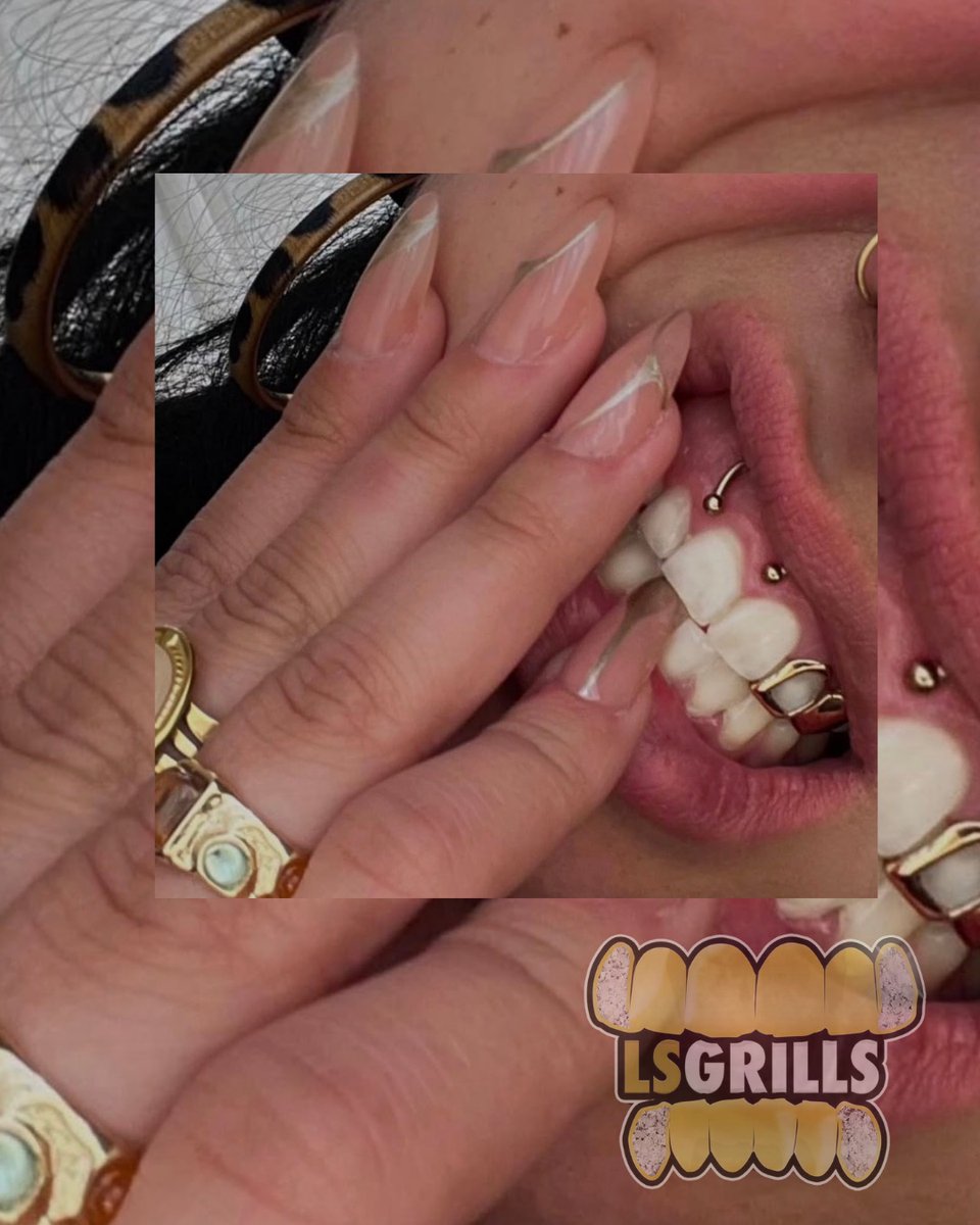LsGrills's tweet image. Girls With Grillz 😻 Yellow Gold 14k #grillz #customjewelry #lsgrills