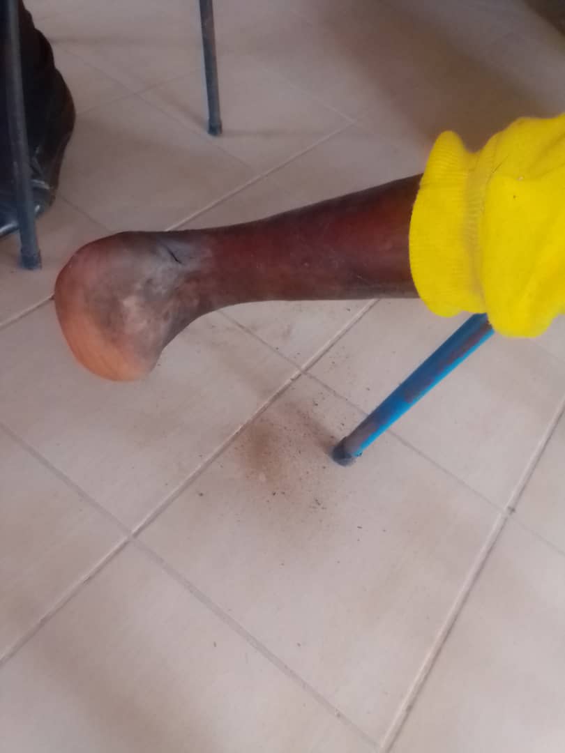 Cornilious33620's tweet photo. This is a worthy cause. Let us join hands and help TAWANANYASHA get an artificial limp from UBH.she is from CHIVI south Chasiyatende Primary. Those who wants to help 
+263 773614921 J Tawodzerwa ecocash. +27837106789 Mukuru Sithole C, Fidus Chimbiti +276161117754 Mukuru. https://t.co/1QMe0uqU2U