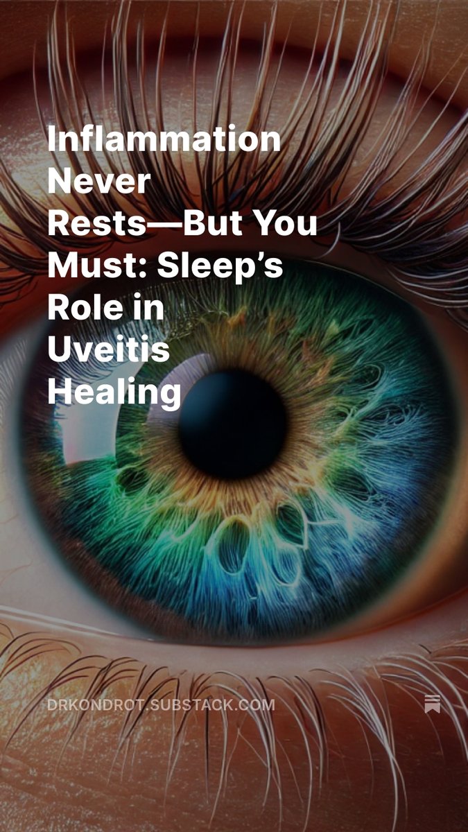 ekondrot's tweet photo. Inflammation Never Rests—But You Must: Sleep’s Role in Uveitis Healing  https://t.co/rJLU9aKcbw https://t.co/Ushpb7YECi